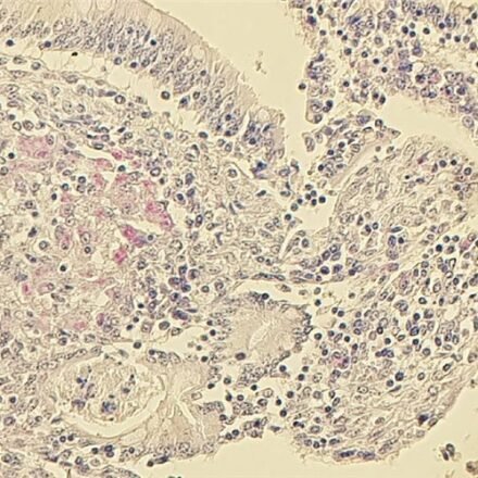 Швидкий кислотний тест на бактерії за Цилем - Нільсеном набір барвників 250 тестів