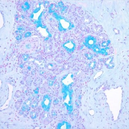 Альциановий блакитний pH 2.5 за Дорлінгом набір барвників 250 тестів