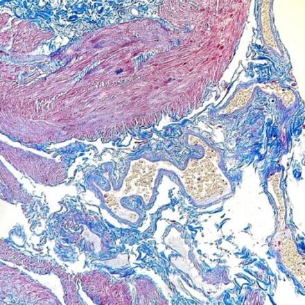 Массон трихром набір барвників 100 тестів