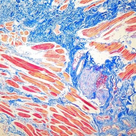 Азан трихром набір барвників 100 тестів