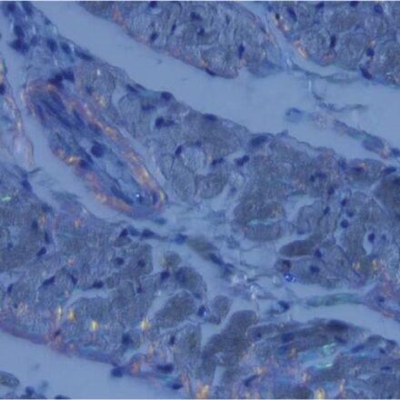 Конго червоний набір барвників 100 тестів