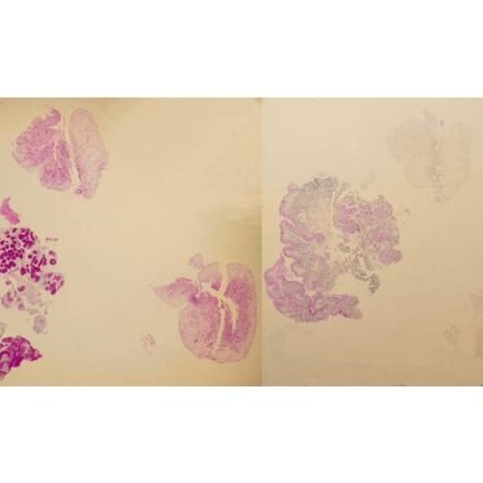 Діастаза забуферена набір барвників 100 тестів