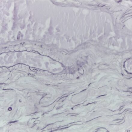 Вейгерт для еластичних волокон (тривалий метод) набір барвників 100 тестів