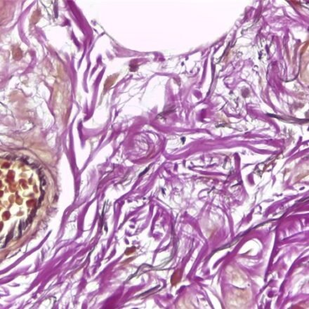 Вейгерт - Ван Гізон (тривалий метод) набір барвників100 тестів