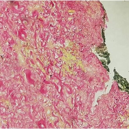 Фуше - Ван Гізон за Кутліком набір барвників 100 тестів