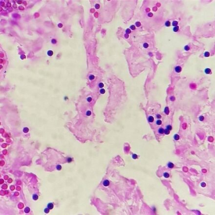 Грам для гістологічних зрізів набір барвників 100 тестів