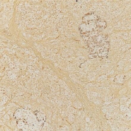 Грімеліус набір барвників 100 тестів