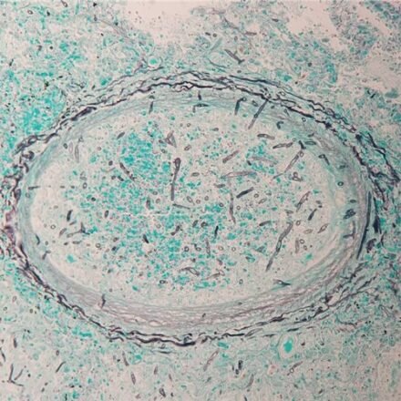Грокотт за Каллардом набір барвників 100 тестів