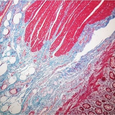 Голднер трихром набір барвників 250 тестів