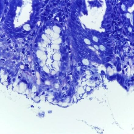 Гімза за Леннертом набір барвників 100 тестів