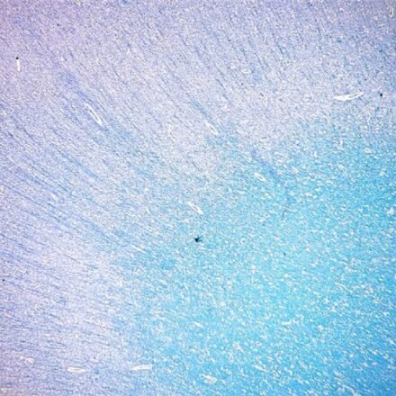 Люксол швидкий блакитний за Клювером - Баррера набір барвників 100 тестів