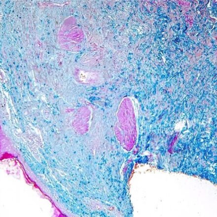 Люксол швидкий блакитний за Клювером - Баррера набір барвників 100 тестів