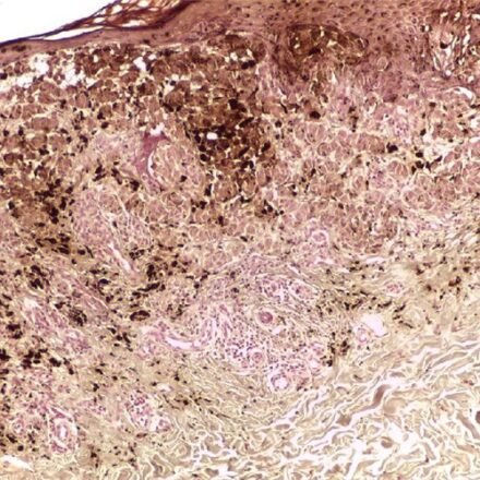 Массон-Фонтана – Microwave набір барвників 100 тестів