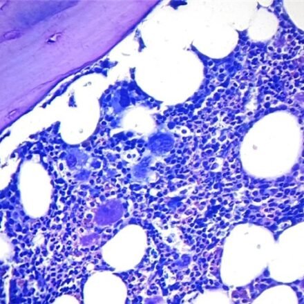 Май - Грюнвальд Гімза за Романовським для тканинних зрізів набір барвників 100 тестів