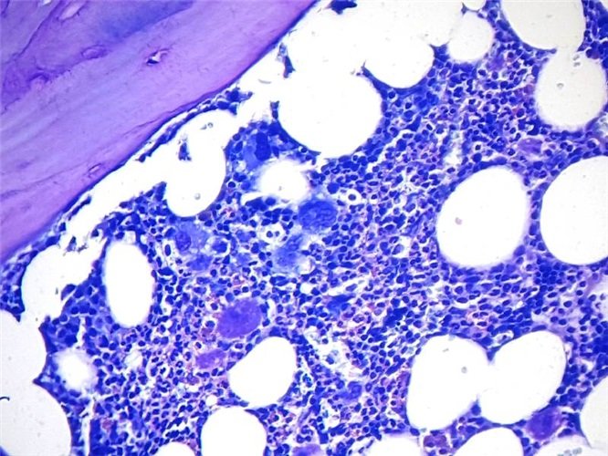 Май - Грюнвальд Гімза за Романовським для тканинних зрізів набір барвників 100 тестів