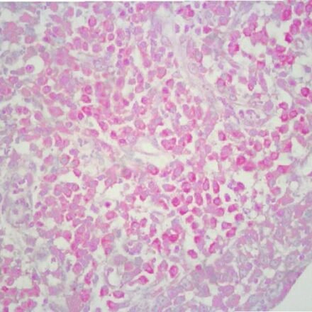 Метиловий зелений піронін за Унна набір барвників 250 тестів