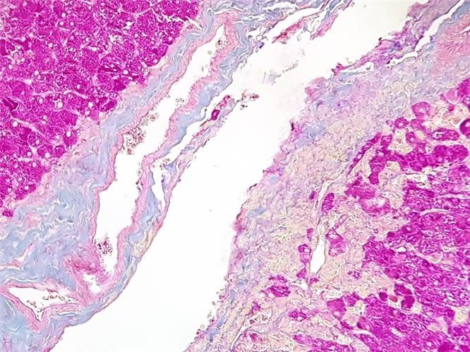 P.A.S. (перйодна кислота Шиффа) за Морель-Маронгер набір барвників 100 тестів