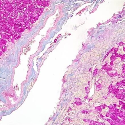 P.A.S. (перйодна кислота Шиффа) за Пірсом набір барвників 250 тестів