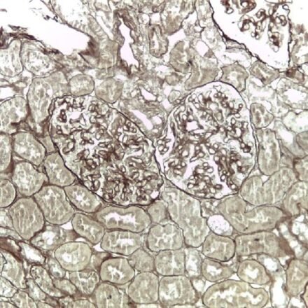 P.A.S.M. Метенамін срібла за Каллардом набір барвників 100 тестів