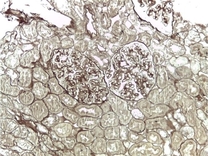 P.A.S.M. Метенамін срібла за Каллардом набір барвників 100 тестів