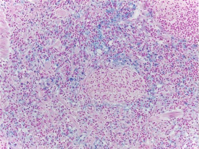 Перльс набір барвників100 тестів