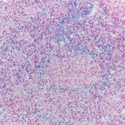 Перльс набір барвників 250 тестів