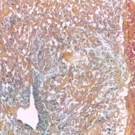 Перльс-Ван Гізон набір барвників 250 тестів