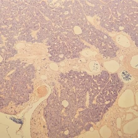 P.T.A.H. фосфовольфрамовий гематоксилін  набір барвників 100 тестів