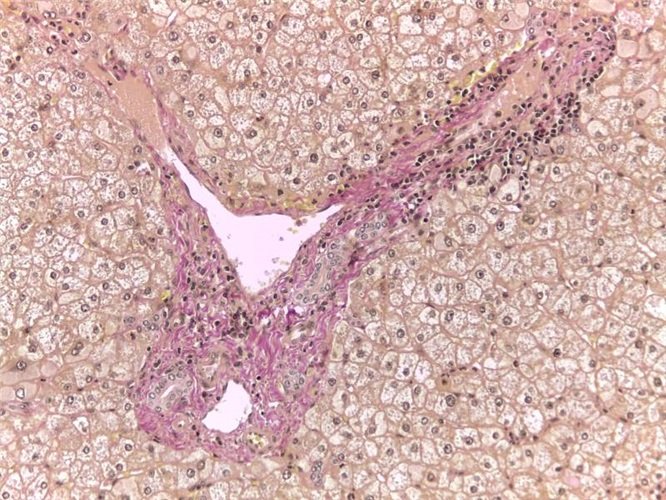 Ван Гізон трихром за Вейгертом набір барвників 100 тестів