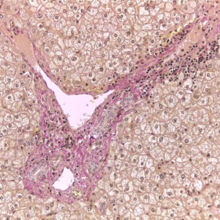 Ван Гізон трихром за Вейгертом  набір барвників 250 тестів