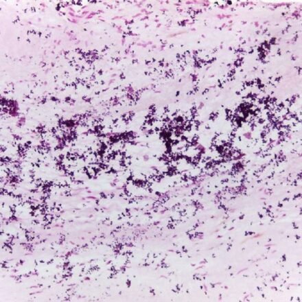 Фон Косса за МакГі - Расселом  набір барвників  100 тестів