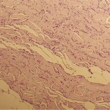 Вейгерт для еластичних волокон (швидкий метод) набір барвників 100 тестів