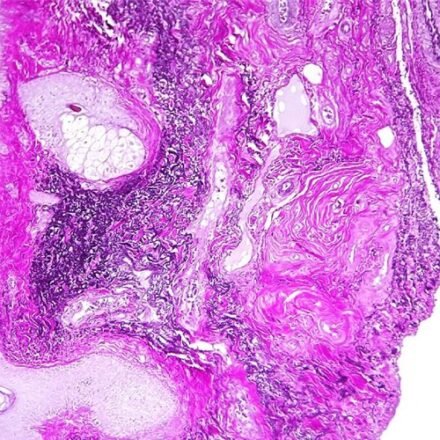 Вейгерт - Ван Гізон (швидкий метод) набір барвників 250 тестів