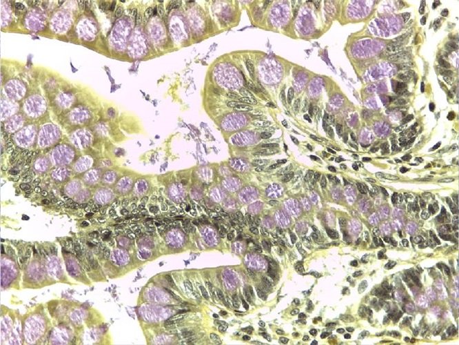 Муцикармін Майера набір барвників 100 тестів