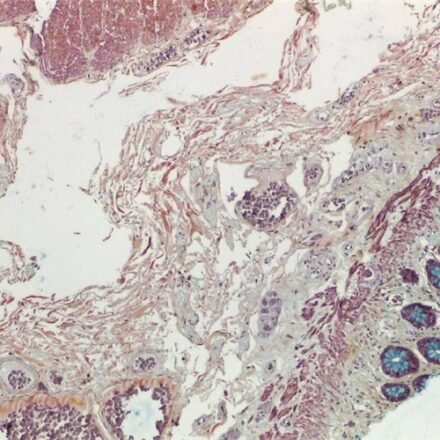 Моват пентахром набір барвників 100 тестів
