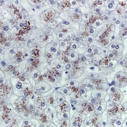 Родамін набір барвників 100 тестів