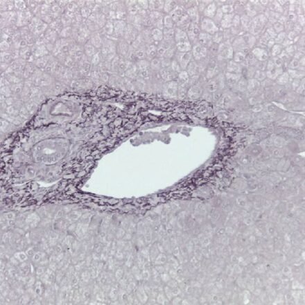 Орсеїн кислий за Шиката набір барвників 250 тестів