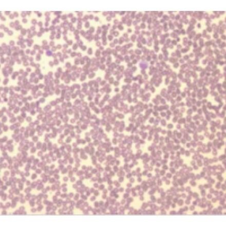 Май Грюнвальд - Гімза (швидкий метод) набір барвників 100 тестів