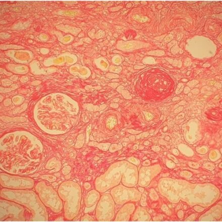 Сіріус червоний для коллагену набір барвників 250 тестів