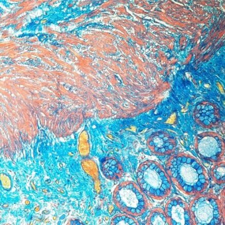 Оранжевий–червоний–голубий MSB набір барвників 250 тестів