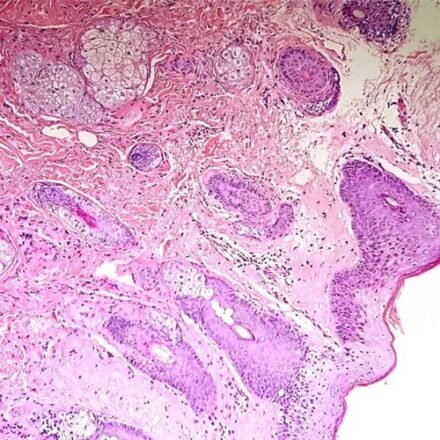 Гематоксилін та Еозин (швидкий метод) набір барвників 100 тестів