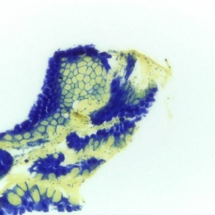 Альциановий жовтий - Толуїдин блакитний 100 тестів