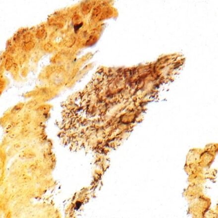 Вартін Старрі  набір барвників 12 препаратів, 4 скельця/препарат