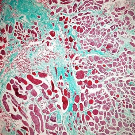 Гоморі трихром набір барвників 250 тестів