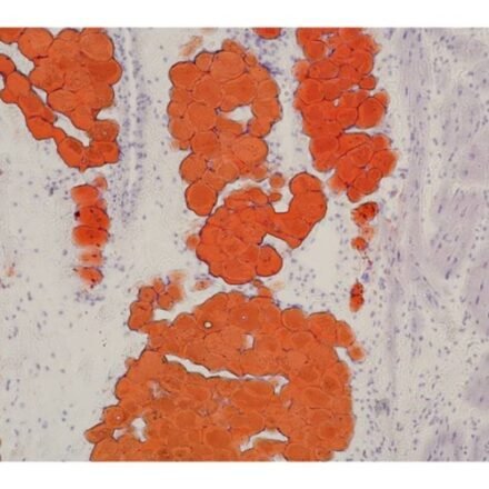 Масляний червоний Oil Red O за Джонсоном набір барвників 250 тестів