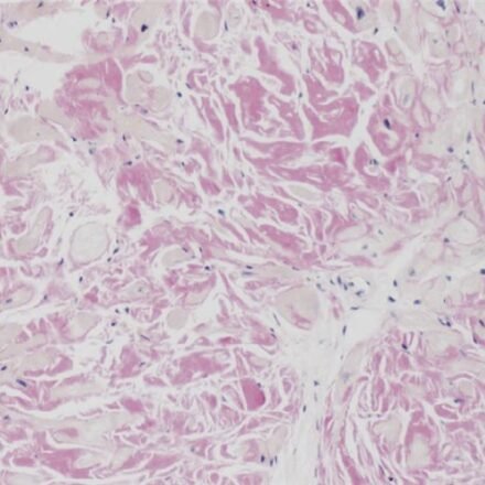 Сіріус червоний для детекції амілоїду набір барвників 250 тестів