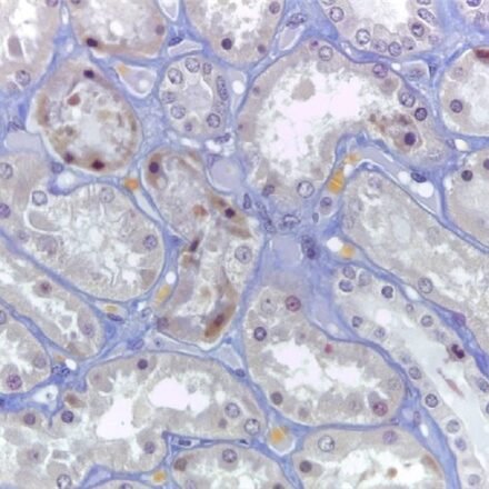 АФОГ (фуксиновий кислий/помаранчевий G) набір барвників 250 тестів