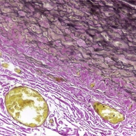 АФОГ (фуксиновий кислий/помаранчевий G) 100 тестів