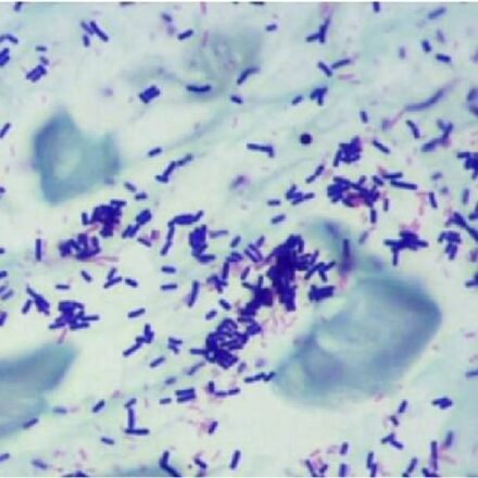 Туорт  набір барвників 100 тестів