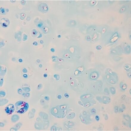 Реакція Хейла набір барвників 100 тестів